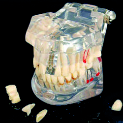 model zębów IQR medical